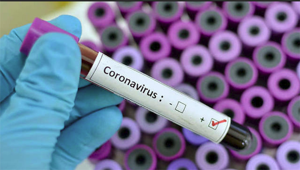 Foto26 Coronavirus Coronavírus já matou mais de 1 mil pessoas na China